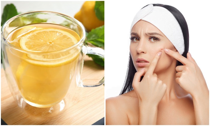 Benefits Of Using Lemon Juice For Dark Spot Removal